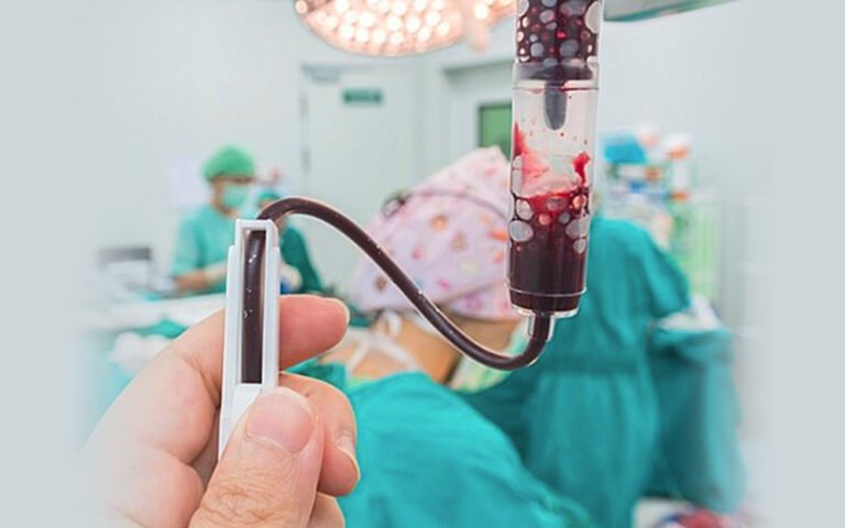 Perioperative Bleeding And Transfusion Management In Pediatrics CHOP OPEN