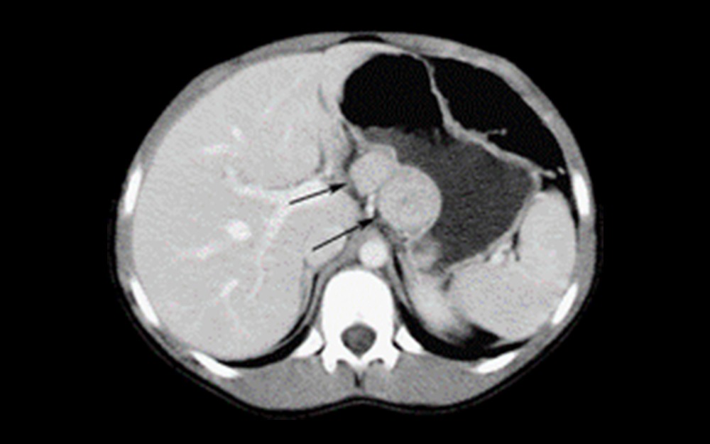 Memorial Hospital Medical Records Phone Number