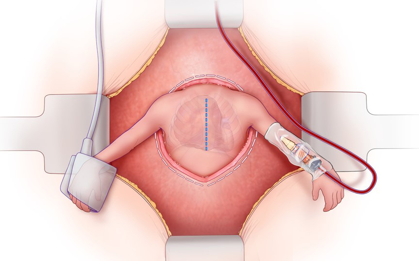 Fetal Cardiovascular Medicine: Where We Are, Where We Need to Be