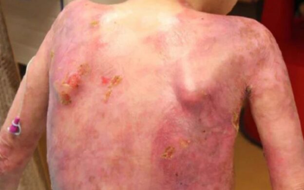 Making Polypharmacy Safer for Children with Medical Complexity