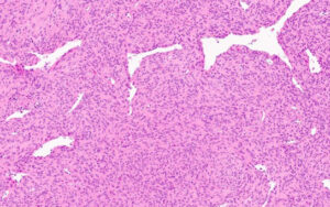 Molecular Biology in the Diagnosis, Prognosis, and Treatment of Solid Tumors