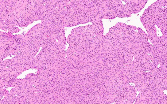 Molecular Biology in the Diagnosis, Prognosis, and Treatment of Solid Tumors