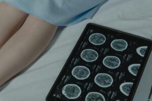 Brain Tumor